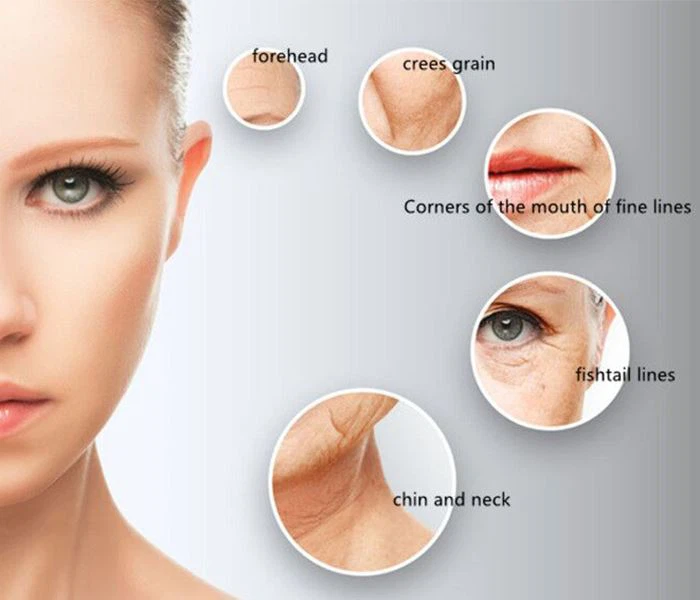 4D HIFU Face Lifting Machine